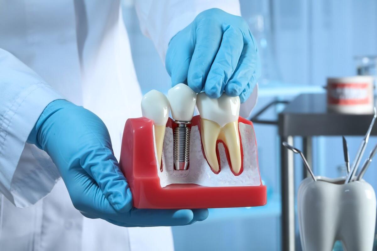 Stefani-Dentista-impianto-dentale